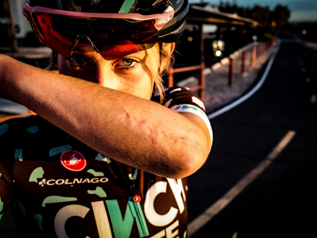 How This Rider Started Her Comeback From A Broken Arm